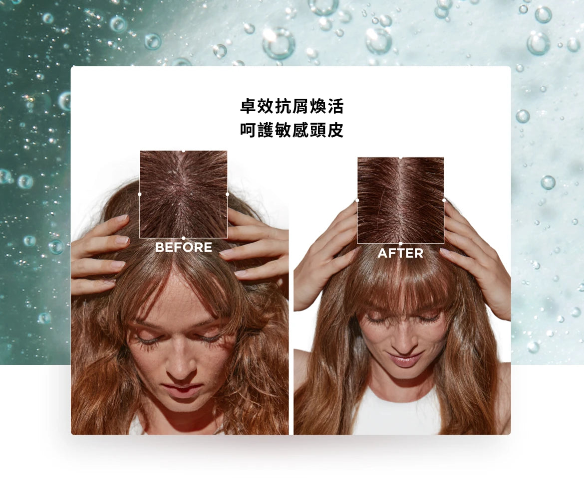 Kerastase SYMOBISE Bain PURETE Antipelliculaire Antidandruff Shampoo潔淨去屑洗髮水